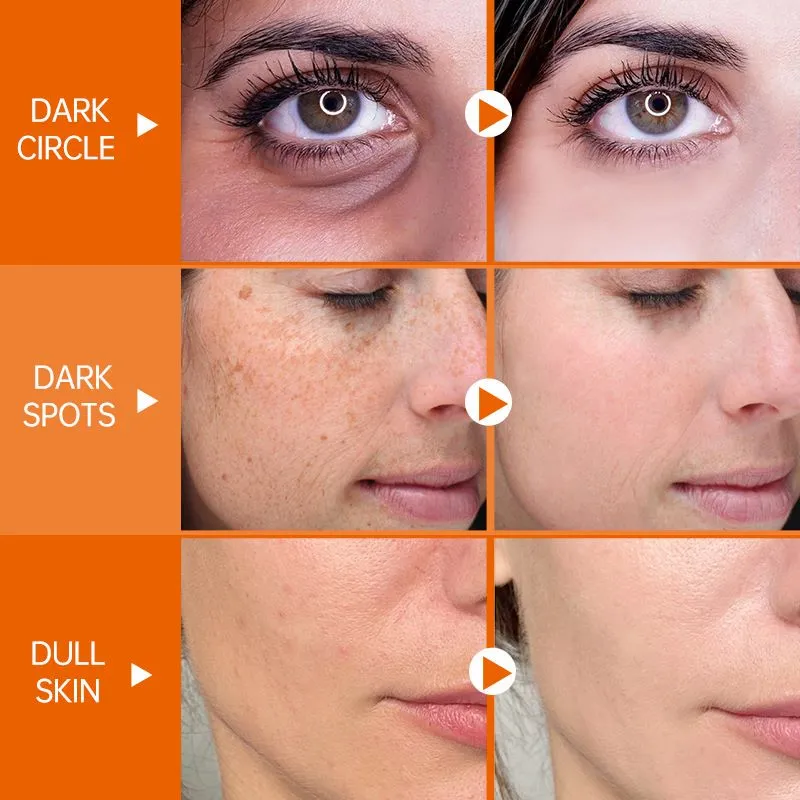 Vitamin C Face Serum Whitening Anti Dark Spot Hyaluronic Acid