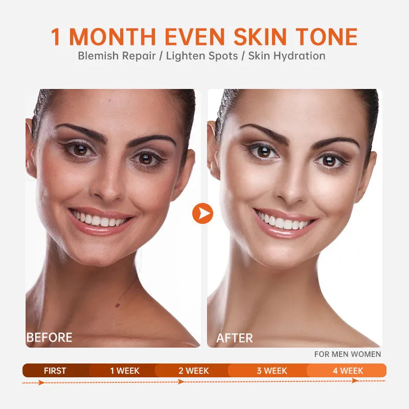 Vitamin C Face Serum Whitening Anti Dark Spot Hyaluronic Acid